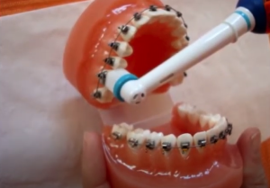 Brosse à dents électrique